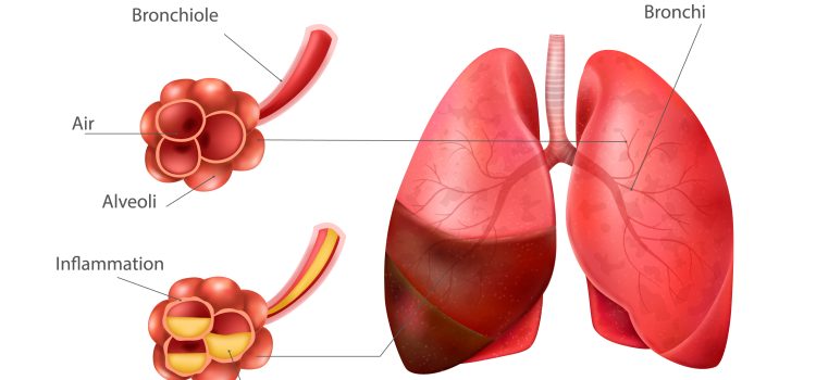 Protecting Your Child Lungs