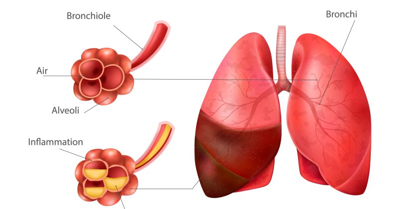 Protecting Your Child Lungs