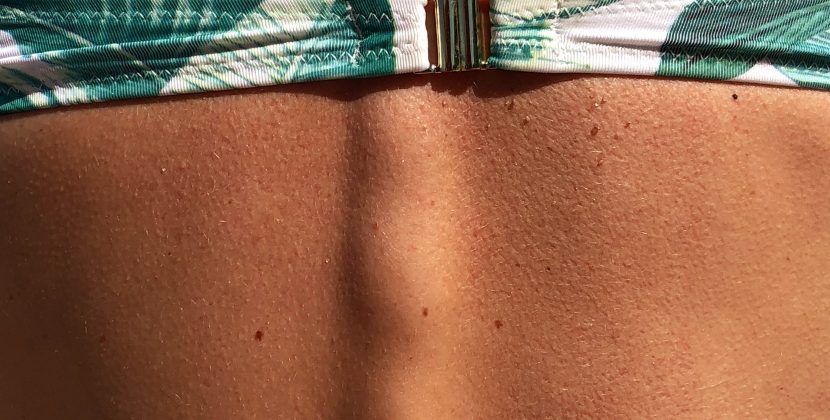 Cutting-Edge Skin Cancer Treatment: Pioneering Advances for Deadly Melanoma