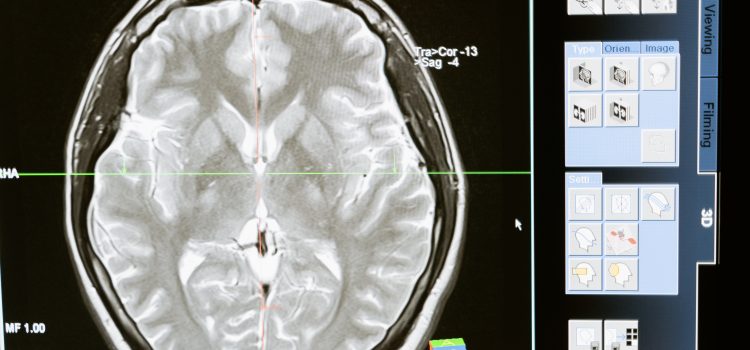 The Latest Developments in Brain-Computer Interfaces and Their Applications in the US