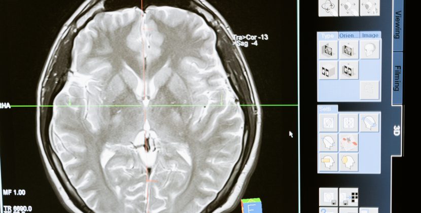 The Latest Developments in Brain-Computer Interfaces and Their Applications in the US