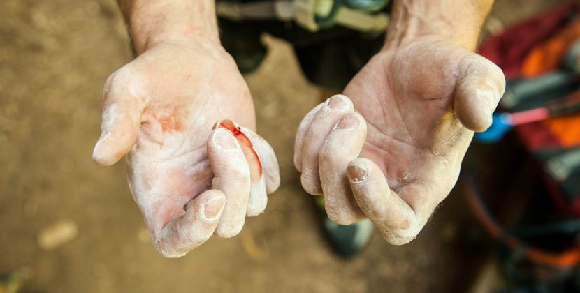 Investigation Launched After British Man Dies from Rare Blood Syndrome