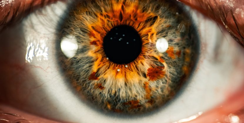 The Ultimate Guide to Banishing Dark Circles and Bags: Tips and Tricks for a Brighter Look