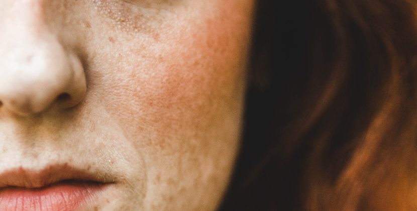 Clear Up Your Skin: A Guide to a Dry Acne Prone Skincare Routine