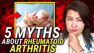 Rheumatoid Arthritis