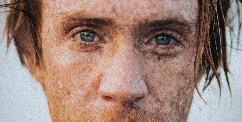 Dr Adeela’s Guide to Banishing Pigmentation