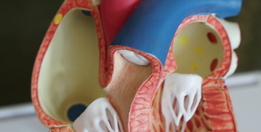 How to Reduce Sodium Intake and Improve Heart Health