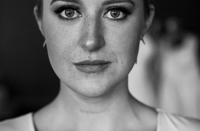 The Ultimate Guide to Natural Blackhead Removal: 5 Simple Solutions