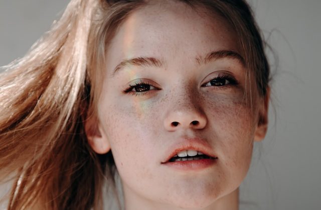 The Ultimate Guide to Dealing with Melasma and Boosting Confidence