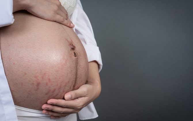 Pregnants!!! Must Read if you Want to Save your Skin