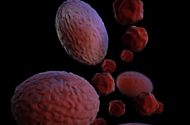 Navigating Life with Early-Stage Chronic Kidney Disease