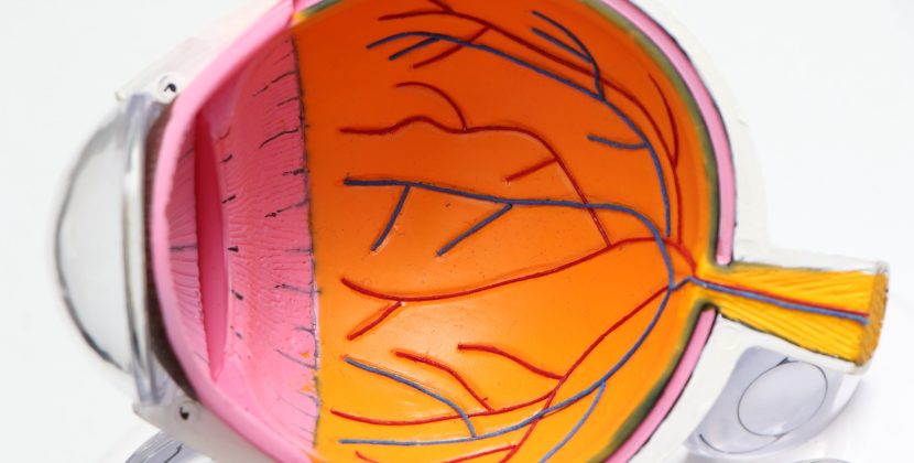 Recovery time for lens surgery