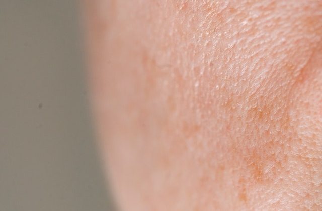 The Ultimate Guide to Minimizing Your Pores for Flawless Skin