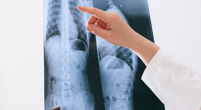 Clean Air, Clear Lungs How to Maintain Optimal Respiratory Health
