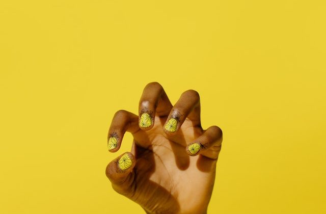 Yellow Nail Syndrome: What You Need to Know and How to Manage It