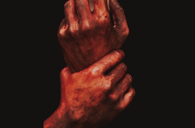 The Importance of Seeking Treatment for an Arm Fracture