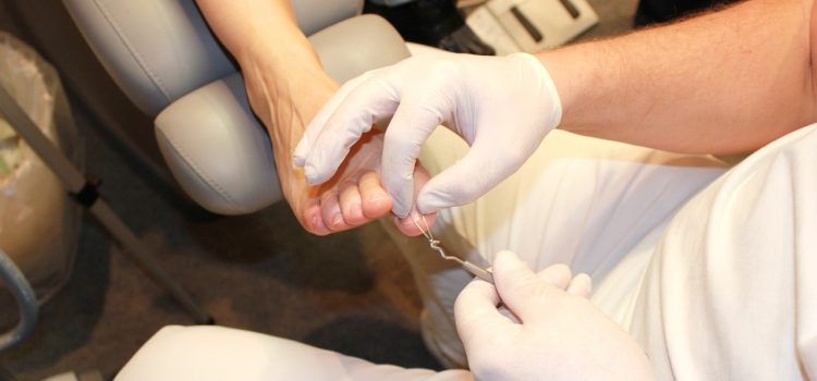 Nail surgery complications