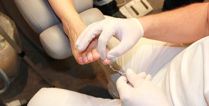 Nail surgery complications