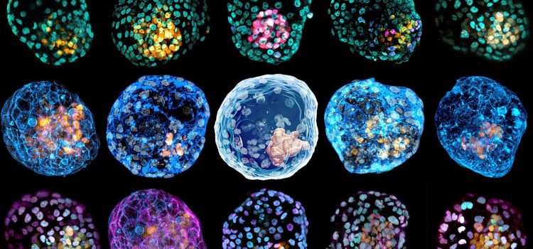 Unraveling Human Embryo Replica Developments: Insights & Implications