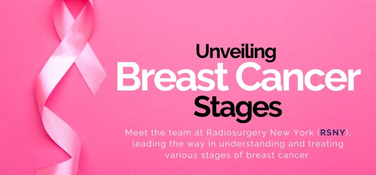 Decoding the Stages of Breast Cancer: An Expert Analysis by Radiosurgery New York (RSNY)