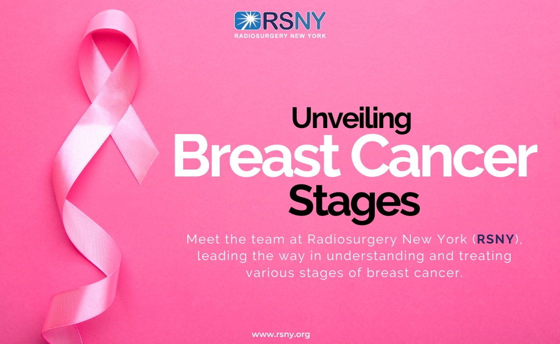 Unveiling Breast Cancer Stages