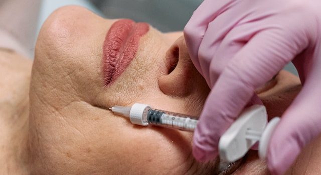 Art and Science of Facial Fillers: Mastering Aesthetics