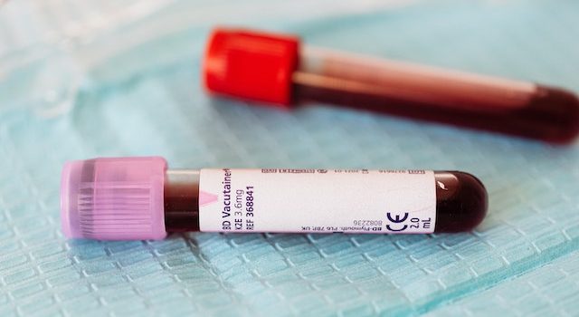 Preventing & Managing Blood Transfusion Complications