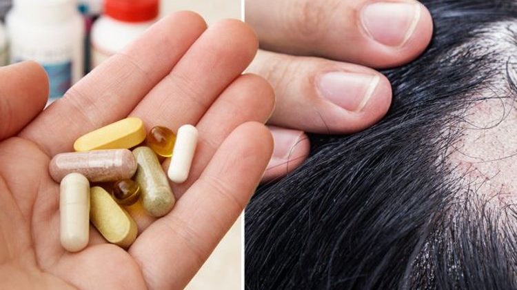 Medications and Hair Loss