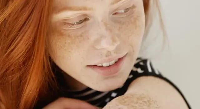 Demystifying Freckles: Causes, Treatments, and Tips