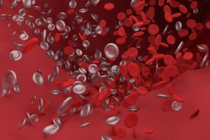 Blood Clots