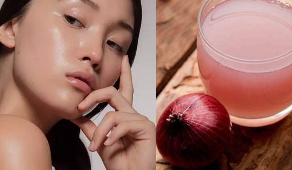 Unlock the Power of Onions: A Natural Elixir for Radiant Skin by Tammie Umbel