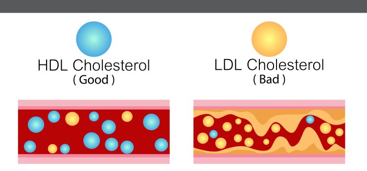 Delicious Recipes That Promote Healthy Cholesterol Levels