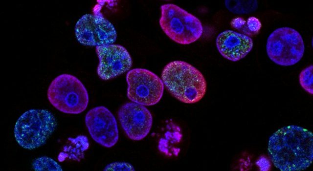 Nature’s Puzzle: A New Stem Cell Key to Unlocking Cancer Secrets