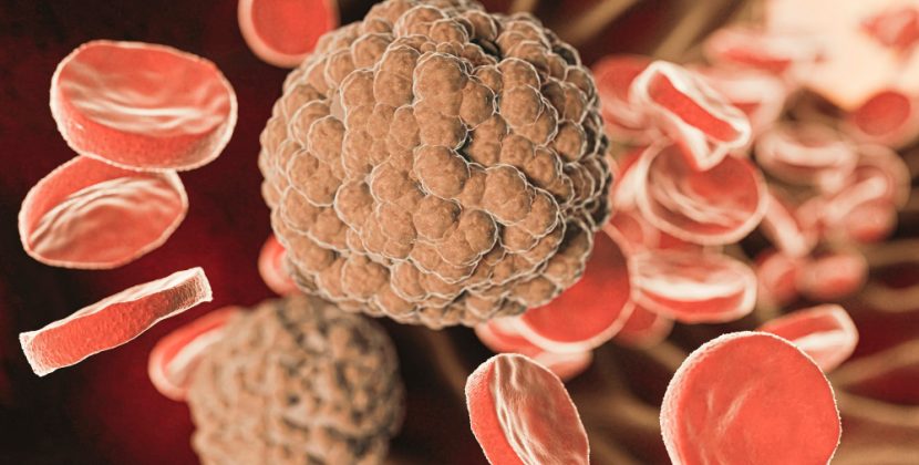 Unseen Peril: Treatment Scarcity Claims Lives in Congenital Syphilis Cases