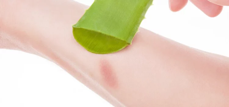 Nature’s Rx: Harnessing Aloe Vera and Protein-Packed Diets for Speedy Home Wound Healing by Rosemary Gladstar