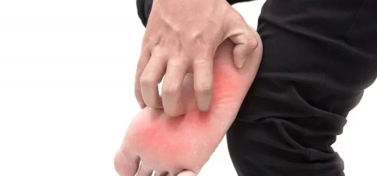 Beyond Diabetes: Dr. Irl Hirsch Unravels the Causes of Burning Feet, Igniting Insights for Lasting Relief