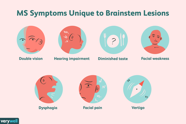 Monsoons and Brain Infections: Health Risks and Precautions