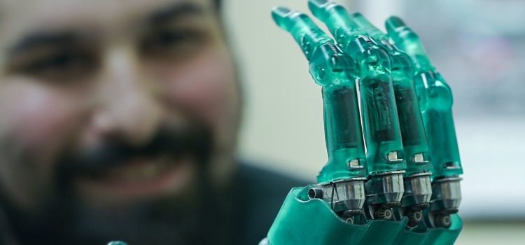 3D Printing: A Game-Changer for Prosthetics