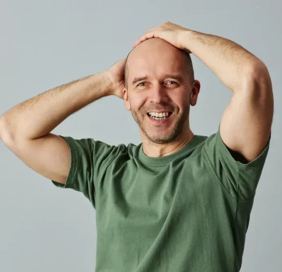 Embrace Baldness with Confidence