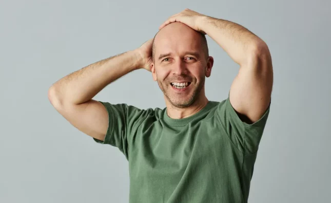 Embrace Baldness with Confidence