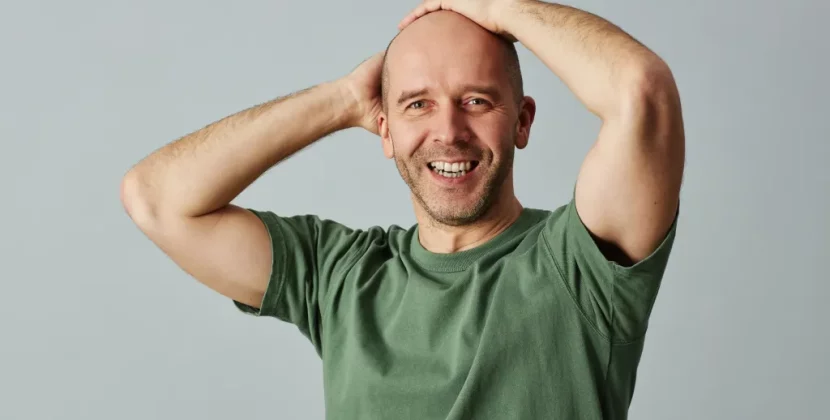 Embrace Baldness with Confidence: Health and Lifestyle Tips