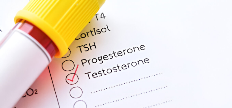 Testosterone Level Test Price Guide: Cost & Importance