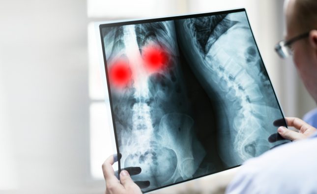 MRI Shoulder Scan Price: A Detailed Guide to Cost and Benefits