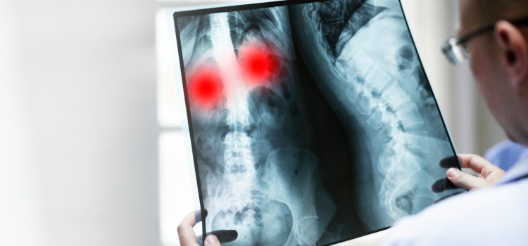 MRI Shoulder Scan Price: A Detailed Guide to Cost and Benefits