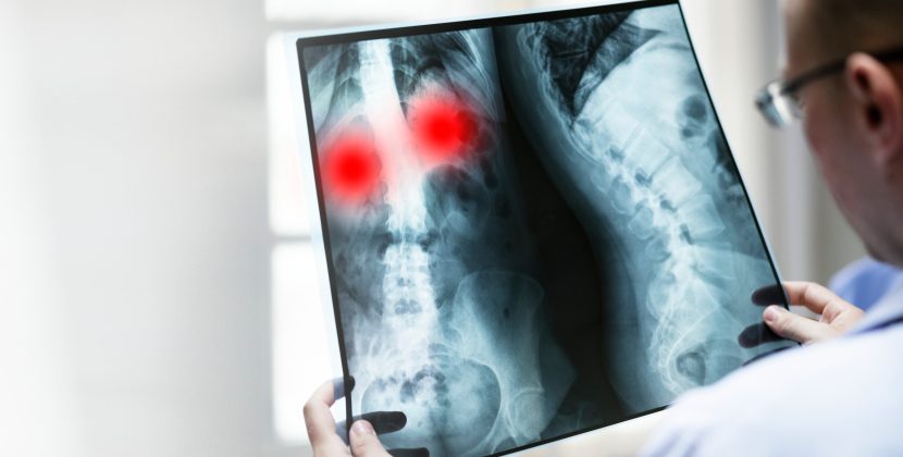 MRI Shoulder Scan Price: A Detailed Guide to Cost and Benefits